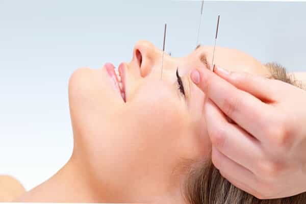 Acupunture
